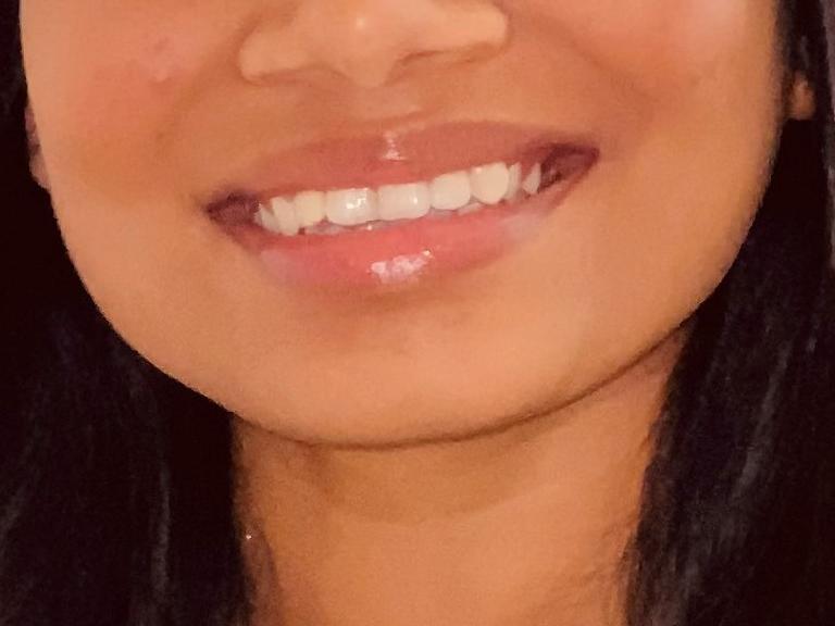 Saloni Patel Intern